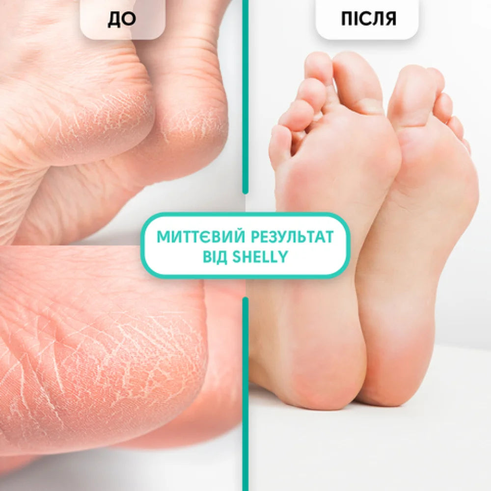 Keratolytic gel for removing calluses and corns Shelly soft blade 200 ml