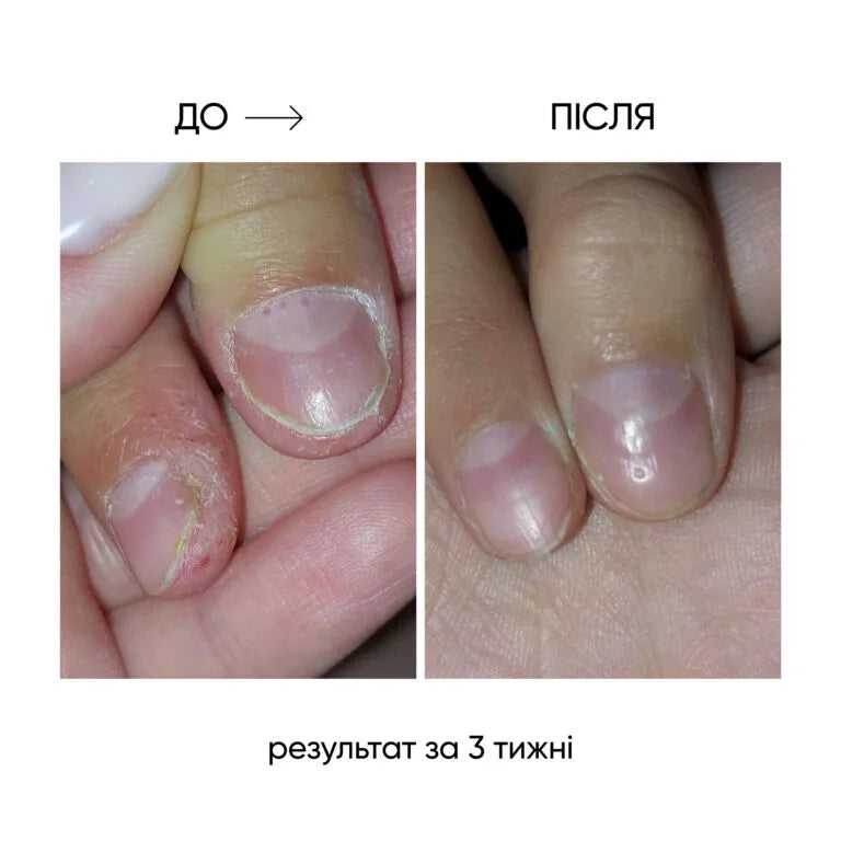 NAILSOFTHEDAY ONISTOP – regenerating oil against onycholysis 15 ml